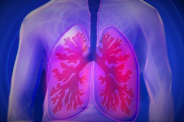 Asbestlint Explained: The Invisible Asbestos Hazard Lurking in Homes & Workplaces