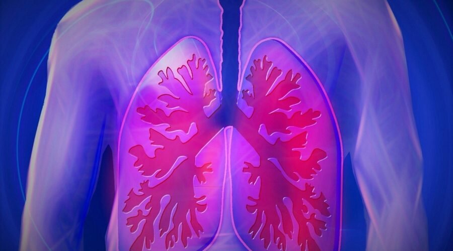 Image of Lungs Asbestlint